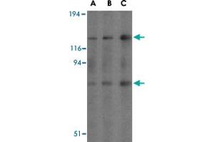 Western blot analysis of AGAP2 in mouse brain tissue lysates with AGAP2 polyclonal antibody  at (A) 0. (AGAP2 Antikörper  (C-Term))