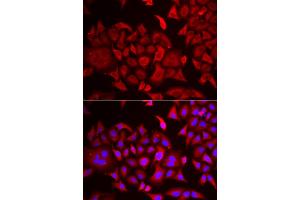 Immunofluorescence analysis of HeLa cells using TARS antibody (ABIN5974207). (TARS Antikörper)