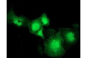 Anti-RASD2 mouse monoclonal antibody (ABIN2453962) immunofluorescent staining of COS7 cells transiently transfected by pCMV6-ENTRY RASD2 (RC201454). (RASD2 Antikörper)