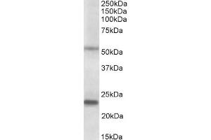 ABIN1049517 (0. (MMP3 Antikörper  (AA 459-473))