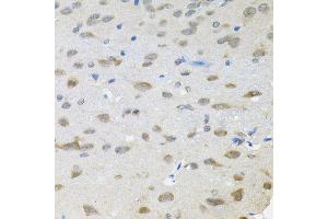 Immunohistochemistry of paraffin-embedded rat brain using TRPC1 antibody (ABIN6003660) (40x lens). (TRPC1 Antikörper)