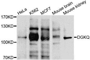Western blot analysis of extracts of various cells, using DGKQ antibody.