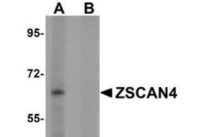 Western blot analysis of ZSCAN4 in mouse lung tissue lysate with AP31008PU-N in (A) the absence and (B) presence of peptide blocking. (ZSCAN4 Antikörper  (C-Term))