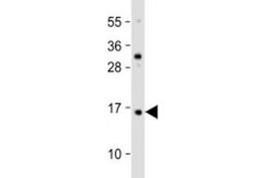 Western blot testing of human HaCaT cell lysate with TCTA antibody at 1:2000. (TCTA Antikörper  (AA 23-55))