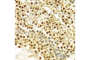 Immunohistochemistry of paraffin-embedded Rat testis using MYSM1 antibody at dilution of 1:100 (x400 lens). (MYSM1 Antikörper  (C-Term))