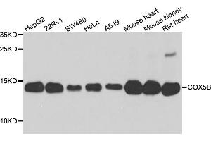 Western blot analysis of extracts of various cell lines, using COX5B antibody. (COX5B Antikörper)