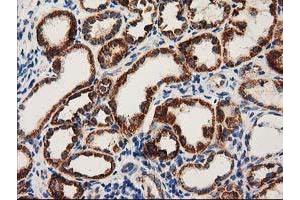 Immunohistochemical staining of paraffin-embedded Human Kidney tissue using anti-MMAB mouse monoclonal antibody. (MMAB Antikörper)
