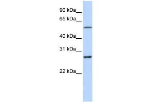 RNF217 antibody used at 1 ug/ml to detect target protein.