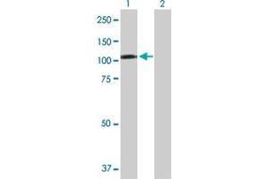 Western Blot analysis of CBL expression in transfected 293T cell line by CBL MaxPab polyclonal antibody.