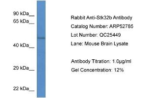 Western Blotting (WB) image for anti-serine/threonine Kinase 32B (STK32B) (N-Term) antibody (ABIN2785092) (STK32B Antikörper  (N-Term))