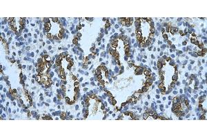Rabbit Anti-KRT8 Antibody       Paraffin Embedded Tissue:  Human alveolar cell   Cellular Data:  Epithelial cells of renal tubule  Antibody Concentration:   4. (KRT8 Antikörper  (N-Term))