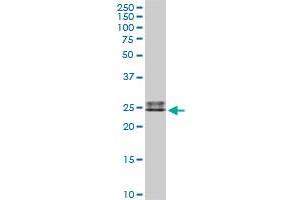 IGLL1 MaxPab rabbit polyclonal antibody. (IGLL1 Antikörper  (AA 1-213))