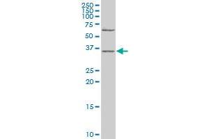Western Blotting (WB) image for anti-DNA Fragmentation Factor, 40kDa, beta Polypeptide (Caspase-Activated DNase) (DFFB) (AA 229-338) antibody (ABIN560596)