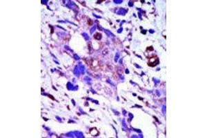 Image no. 1 for anti-Polo-Like Kinase 1 (PLK1) (C-Term) antibody (ABIN360333) (PLK1 Antikörper  (C-Term))