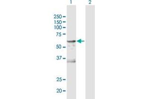 Western Blot analysis of CA9 expression in transfected 293T cell line by CA9 MaxPab polyclonal antibody. (CA9 Antikörper  (AA 1-459))