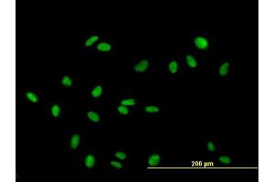 Immunofluorescence of purified MaxPab antibody to RAD18 on HeLa cell. (RAD18 Antikörper  (AA 1-495))