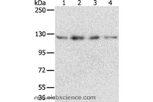 Western blot analysis of Huvec, hepg2, 293T and A549 cell, using RBM5 Polyclonal Antibody at dilution of 1:500