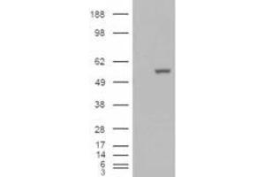 HEK293 overexpressing ALDH1A1 (ABIN5493687) and probed with ABIN184581 (mock transfection in first lane). (ALDH1A1 Antikörper  (C-Term))