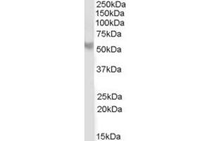 ABIN184652 (2µg/ml) staining of Human Cerebellum lysate (35µg protein in RIPA buffer). (PPP2R5B Antikörper  (C-Term))