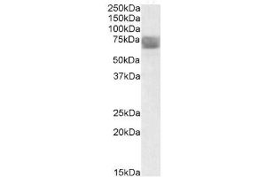Image no. 1 for anti-Tripeptidyl Peptidase I (TPP1) (Internal Region) antibody (ABIN401515) (TPP1 Antikörper  (Internal Region))
