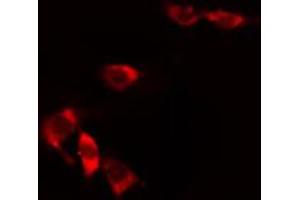 ABIN6274825 staining HuvEc cells by IF/ICC. (ALDH3B1 Antikörper  (N-Term))