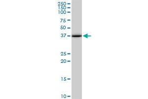 ACOT7 monoclonal antibody (M02), clone 1E7. (ACOT7 Antikörper  (AA 1-338))