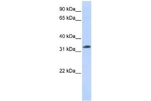WB Suggested Anti-SIAH2 Antibody Titration: 0. (SIAH2 Antikörper  (N-Term))
