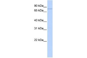 WB Suggested Anti-ZBTB39 Antibody Titration:  0. (ZBTB39 Antikörper  (Middle Region))