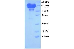 SDS-PAGE (SDS) image for Leucine-Rich Repeat Containing G Protein-Coupled Receptor 5 (LGR5) (AA 22-561) protein (His tag) (ABIN5713602) (LGR5 Protein (AA 22-561) (His tag))