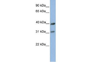 WB Suggested Anti-COX3 Antibody Titration:  0. (COX3 Antikörper  (C-Term))