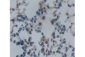 Used in DAB staining on fromalin fixed paraffin- embedded Kidney tissue (Oncostatin M Receptor Antikörper  (AA 410-652))