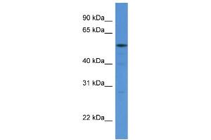 WB Suggested Anti-HARS AntibodyTitration: 1.