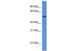 WB Suggested Anti-HARS AntibodyTitration: 1. (HARS1/Jo-1 Antikörper  (N-Term))