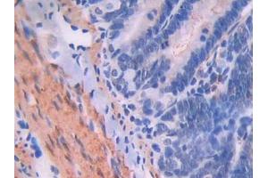 IHC-P analysis of Rat Intestine Tissue, with DAB staining. (Endoglin Antikörper  (AA 26-136))