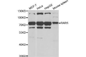 Western blot analysis of extracts of various cell lines, using RARS antibody (ABIN5973728) at 1/1000 dilution. (RARS Antikörper)