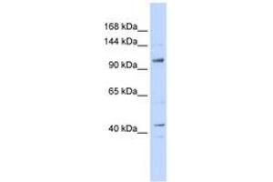 Image no. 1 for anti-TAF4 RNA Polymerase II, TATA Box Binding Protein (TBP)-Associated Factor, 135kDa (TAF4) (AA 935-984) antibody (ABIN6742373) (TAF4 Antikörper  (AA 935-984))