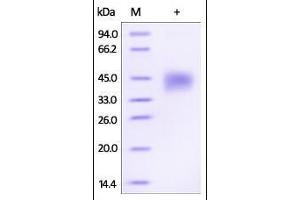 Human Dkk-1, His Tag on SDS-PAGE under reducing (R) condition. (DKK1 Protein (AA 32-266) (His tag))