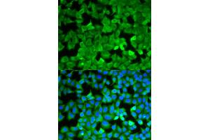 Immunofluorescence analysis of A549 cells using ASNS antibody. (Asparagine Synthetase Antikörper)