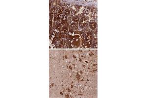 Immunohistochemical staining of human hippocampus with KARS polyclonal antibody  shows strong cytoplasmic positivity in neuronal cells at 1:50-1:200 dilution. (KARS Antikörper)