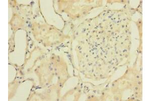 Immunohistochemistry of paraffin-embedded human kidney tissue using ABIN7176509 at dilution of 1:100 (ZNF77 Antikörper  (AA 51-369))