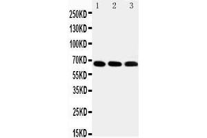 Anti-IRAKM antibody,  Western blotting Lane 1: HELA Cell Lysate Lane 2: JURKAT Cell Lysate Lane 3: HUT102 Cell Lysate (IRAK3 Antikörper  (C-Term))