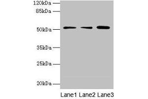 Western blot All lanes: ACSBG2 antibody at 4 μg/mL Lane 1: A431 whole cell lysate Lane 2: K562 whole cell lysate Lane 3: A549 whole cell lysate Secondary Goat polyclonal to rabbit IgG at 1/10000 dilution Predicted band size: 75, 69, 54, 52 kDa Observed band size: 52 kDa (ACSBG2 Antikörper  (AA 301-600))