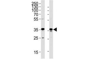 Western blot analysis of lysate from HeLa, HUVEC cell line (left to right) using GAPDH antibody