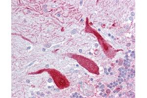 Anti-KCNQ2 antibody IHC of human brain, cerebellum.