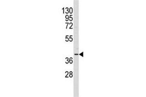 Western blot analysis of AKR1A1 antibody and Y79 lysate (AKR1A1 Antikörper  (AA 293-325))
