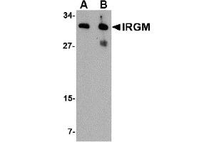 WB Image for AP22614PU-N Western blot analysis of IRGM in human brain lysate with IRGM antibody at (A) 1 and (B) 2 µg/ml.