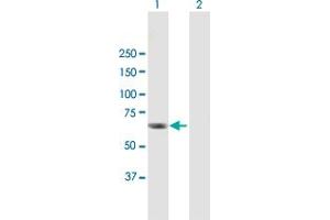 Western Blot analysis of RGS12 expression in transfected 293T cell line by RGS12 MaxPab polyclonal antibody. (RGS12 Antikörper  (AA 1-555))