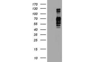 Western Blotting (WB) image for anti-Golgi Membrane Protein 1 (GOLM1) antibody (ABIN1498493)