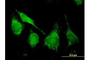 Immunofluorescence of purified MaxPab antibody to CAT on HeLa cell.