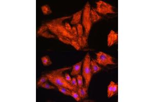 Immunofluorescence analysis of H9C2 cells using Rig-I/DDX58 antibody (ABIN6130263, ABIN6139513, ABIN6139515 and ABIN6217394) at dilution of 1:100. (DDX58 Antikörper  (AA 726-925))